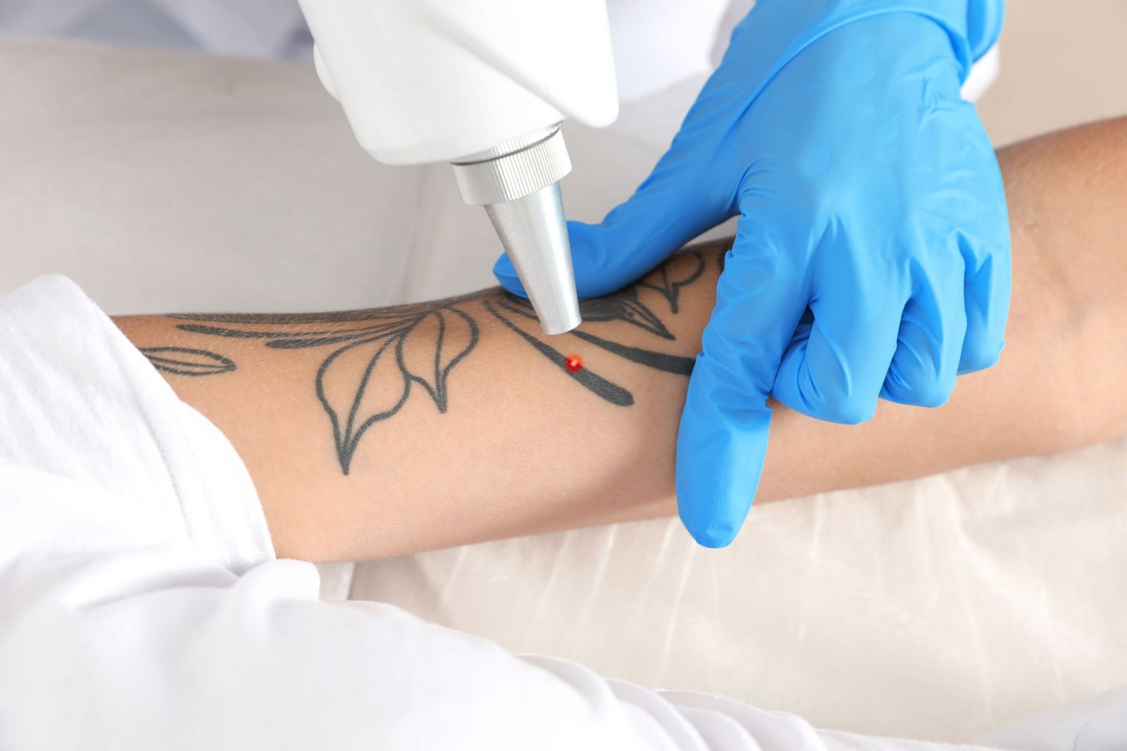 Tattoo Removal Myths